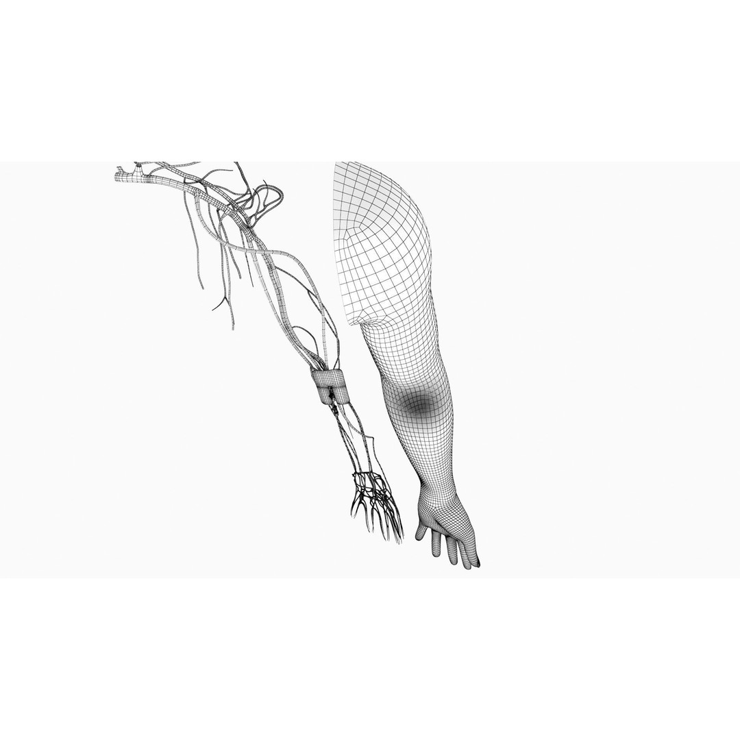 Injected Cannula 3D Model – Low Poly Medical Asset, FBX, Blender - View 12