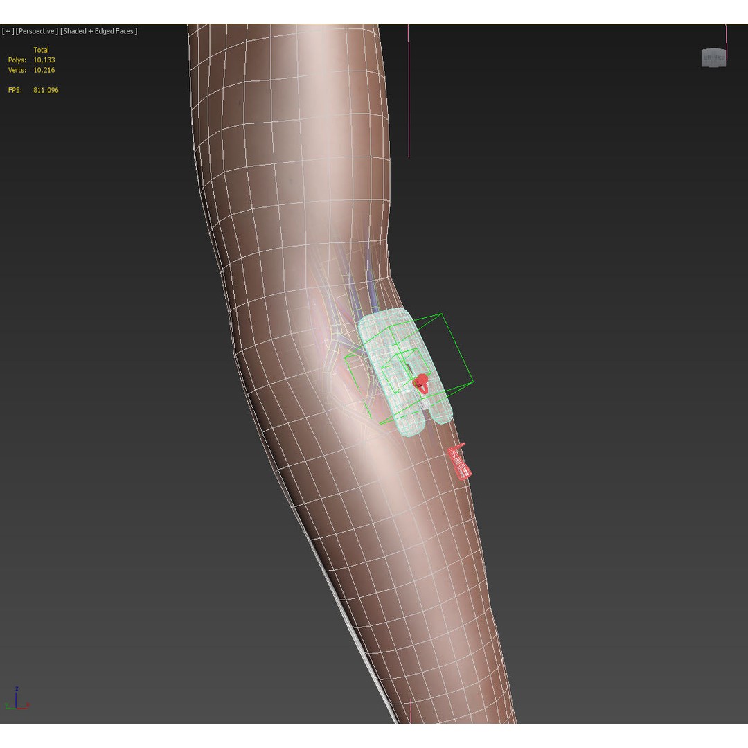 Injected Cannula 3D Model – Low Poly Medical Asset, FBX, Blender - View 23