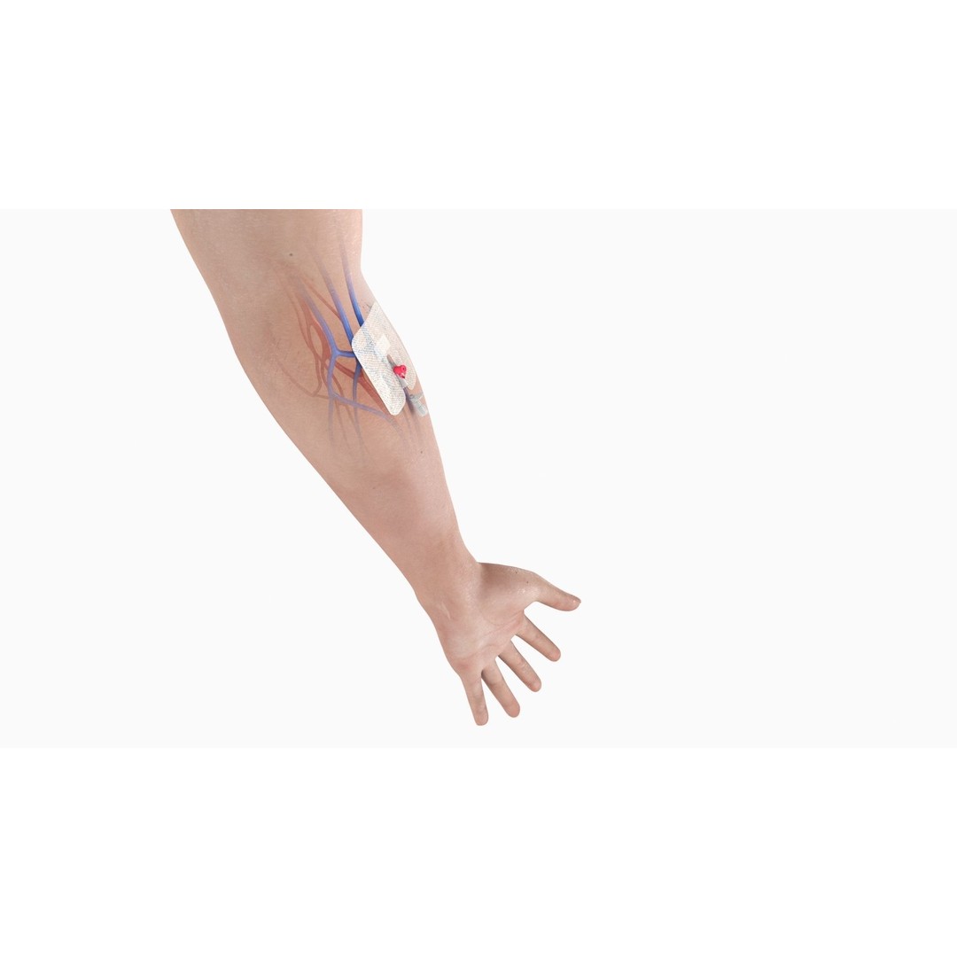 Injected Cannula 3D Model – Low Poly Medical Asset, FBX, Blender - View 5