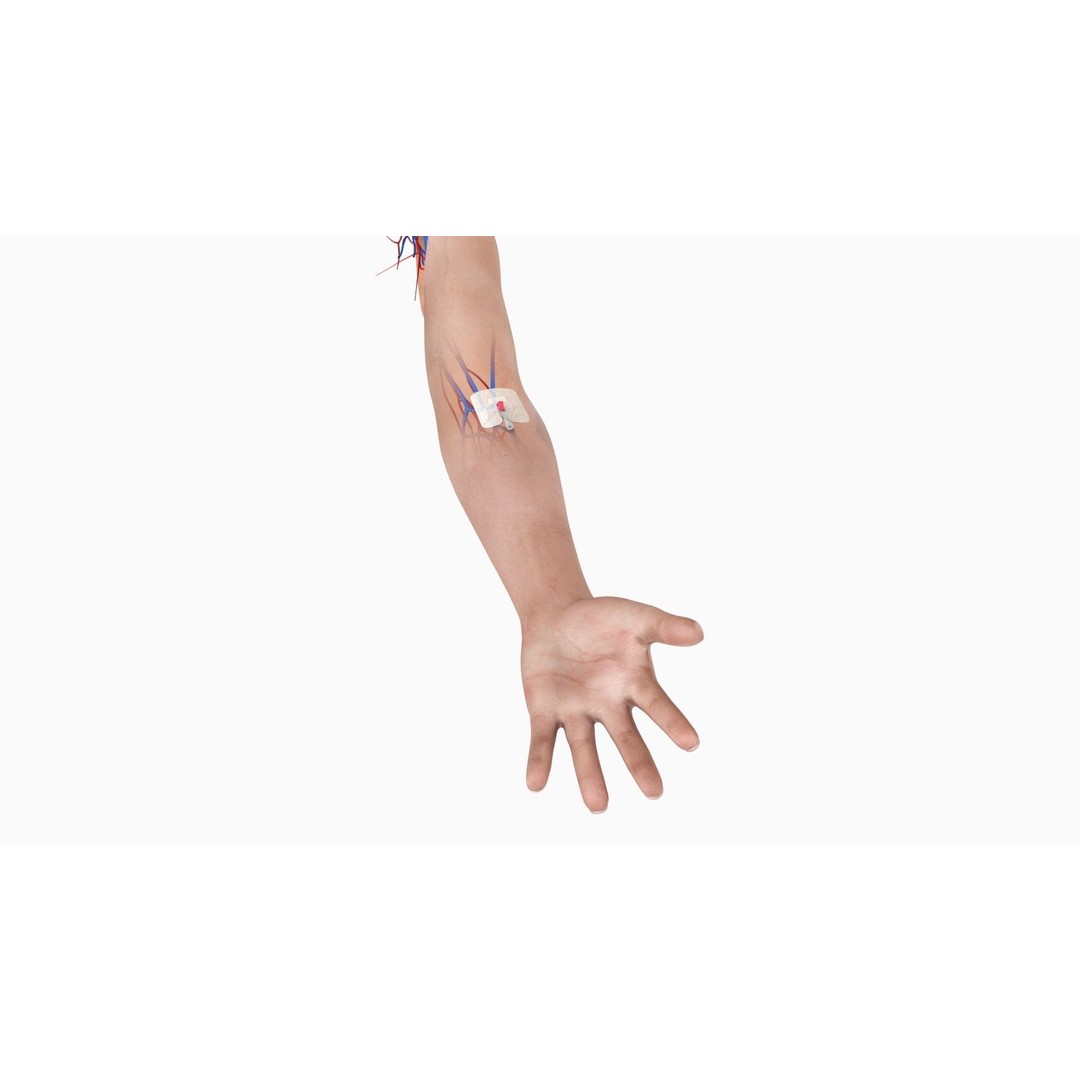 Injected Cannula 3D Model – Low Poly Medical Asset, FBX, Blender - View 6