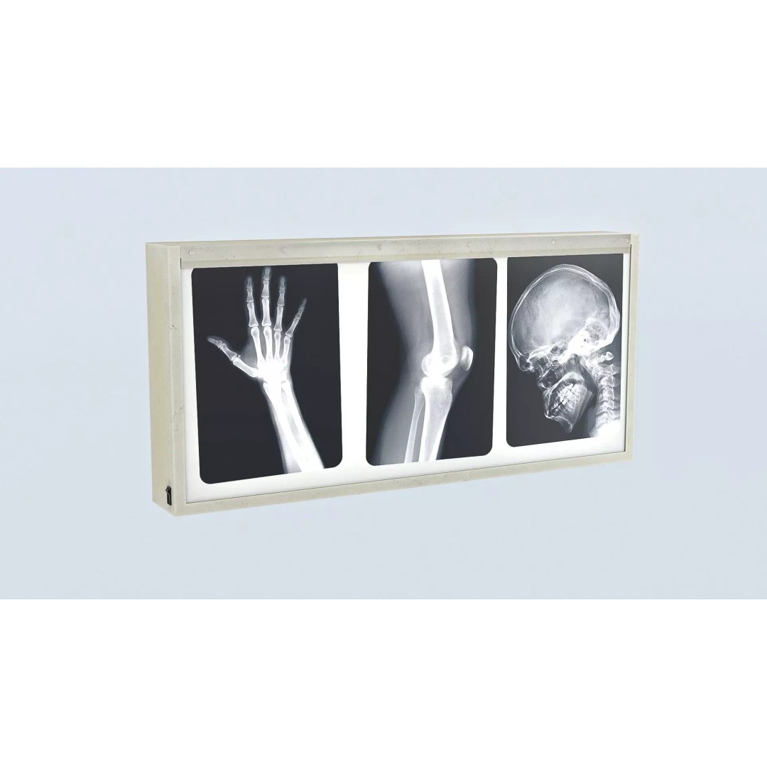X-ray Lightox 3D Model – Low Poly Medical Equipment, FBX, OBJ, Blender - View 2