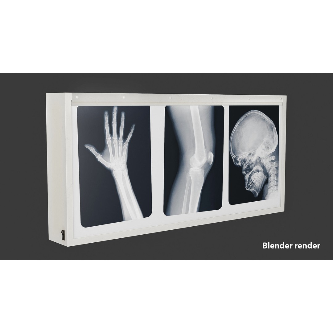 X-ray Lightox 3D Model – Low Poly Medical Equipment, FBX, OBJ, Blender - View 4