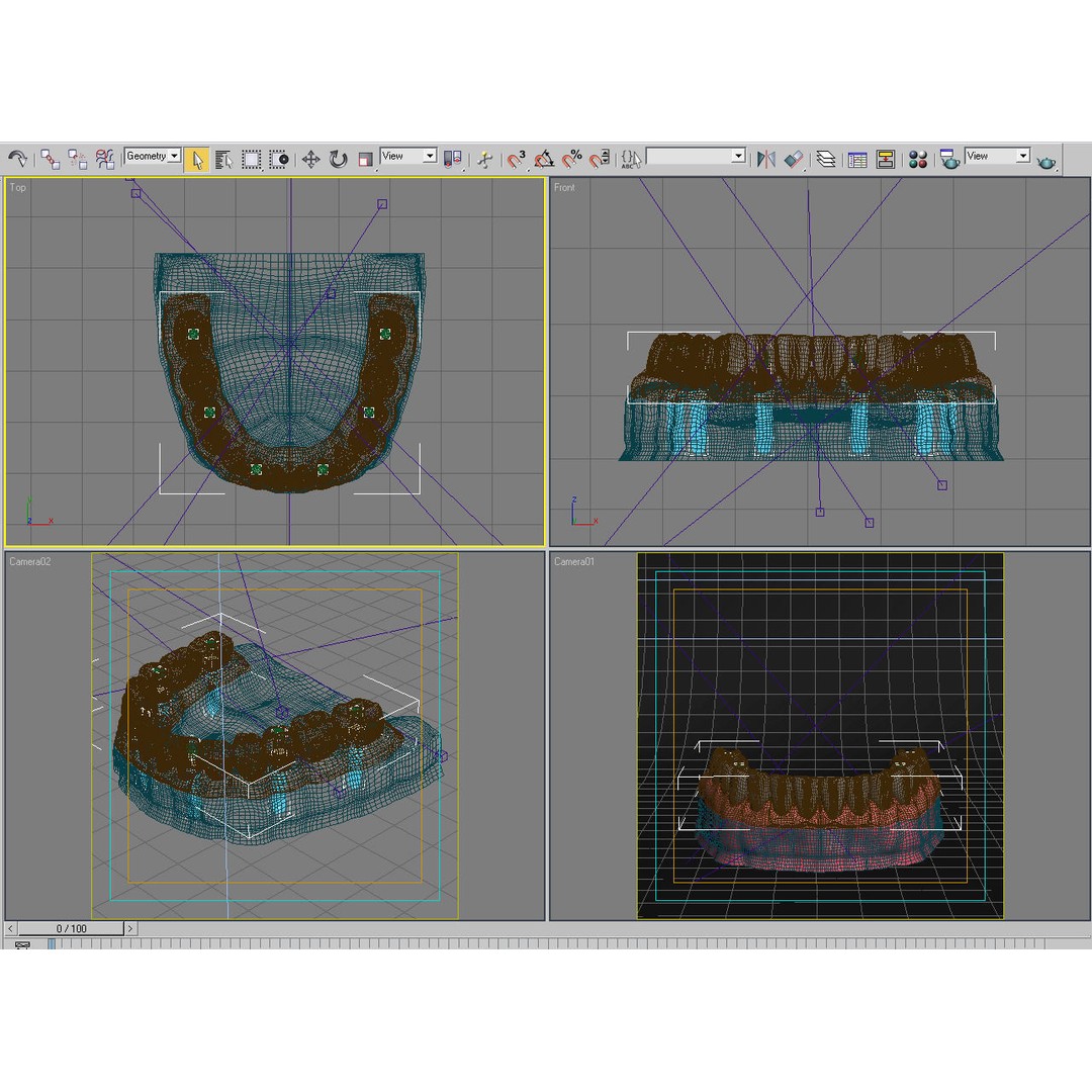 Dental Implant 3D Model – Anatomical Rigged Asset with PBR Textures - View 11