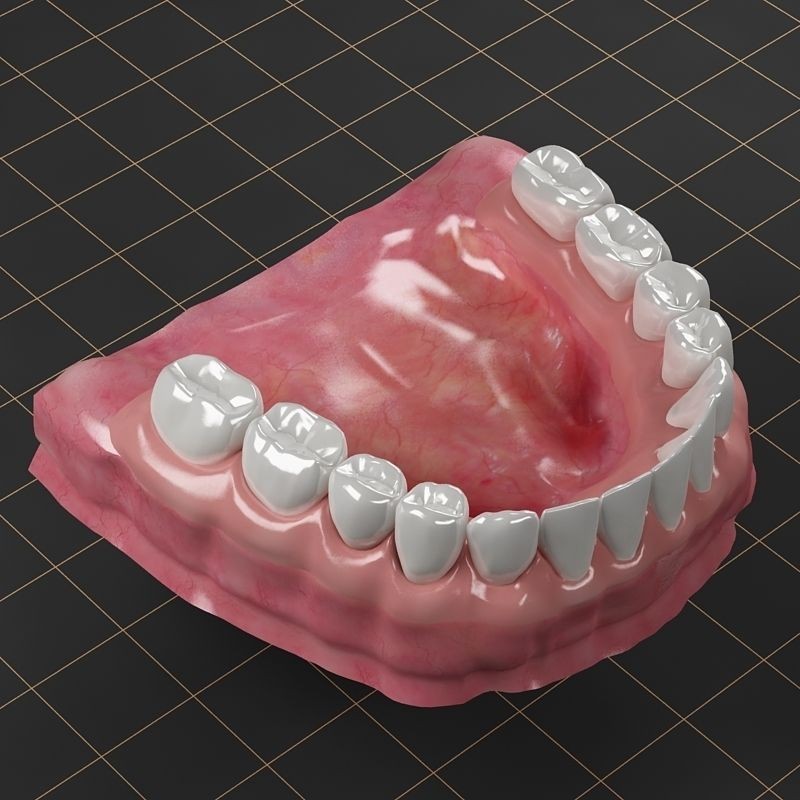 Dental Implant 3D Model – Anatomical Rigged Asset with PBR Textures - View 3