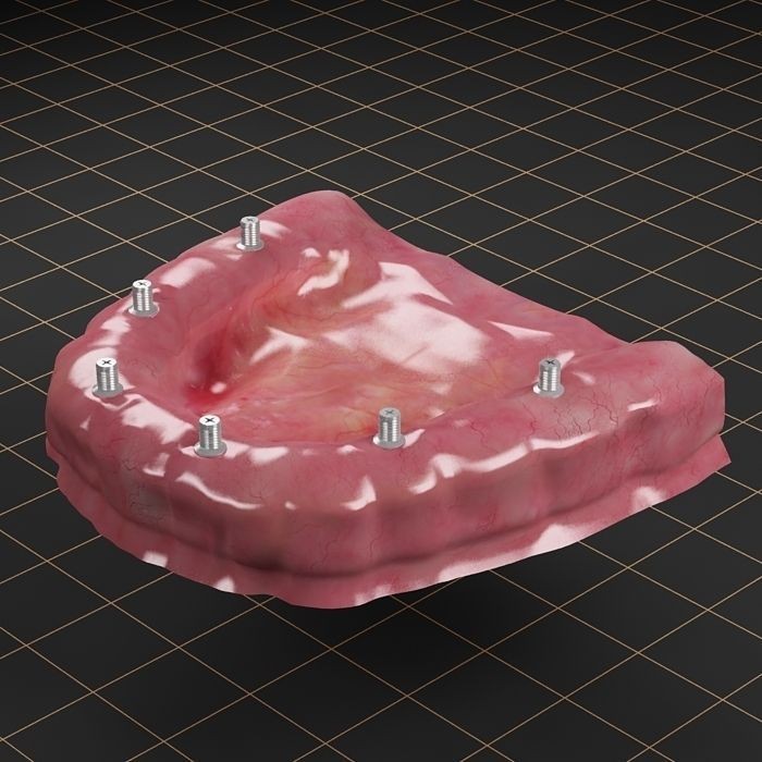 Dental Implant 3D Model – Anatomical Rigged Asset with PBR Textures - View 5