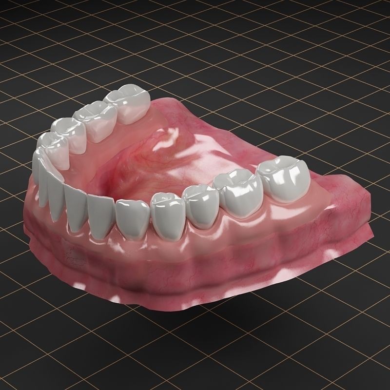 Dental Implant 3D Model – Anatomical Rigged Asset with PBR Textures - View 6