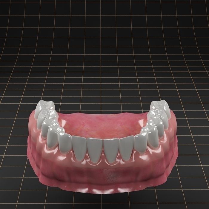 Dental Implant 3D Model – Anatomical Rigged Asset with PBR Textures - View 9
