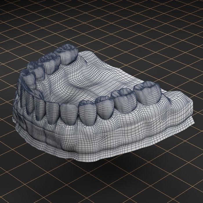Dental Implant 3D Model – Realistic Anatomy Asset, FBX, OBJ - View 23