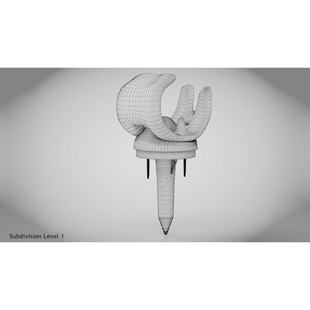 Knee Implant 3D Model – Low Poly Medical Device, PBR Textures, FBX
