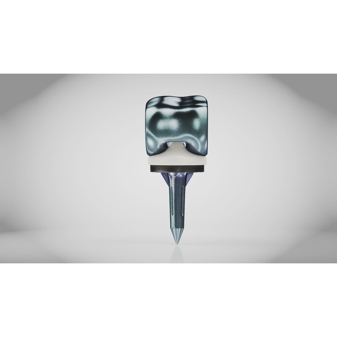 Knee Implant 3D Model – Low Poly Medical Device, PBR Textures, FBX - View 10