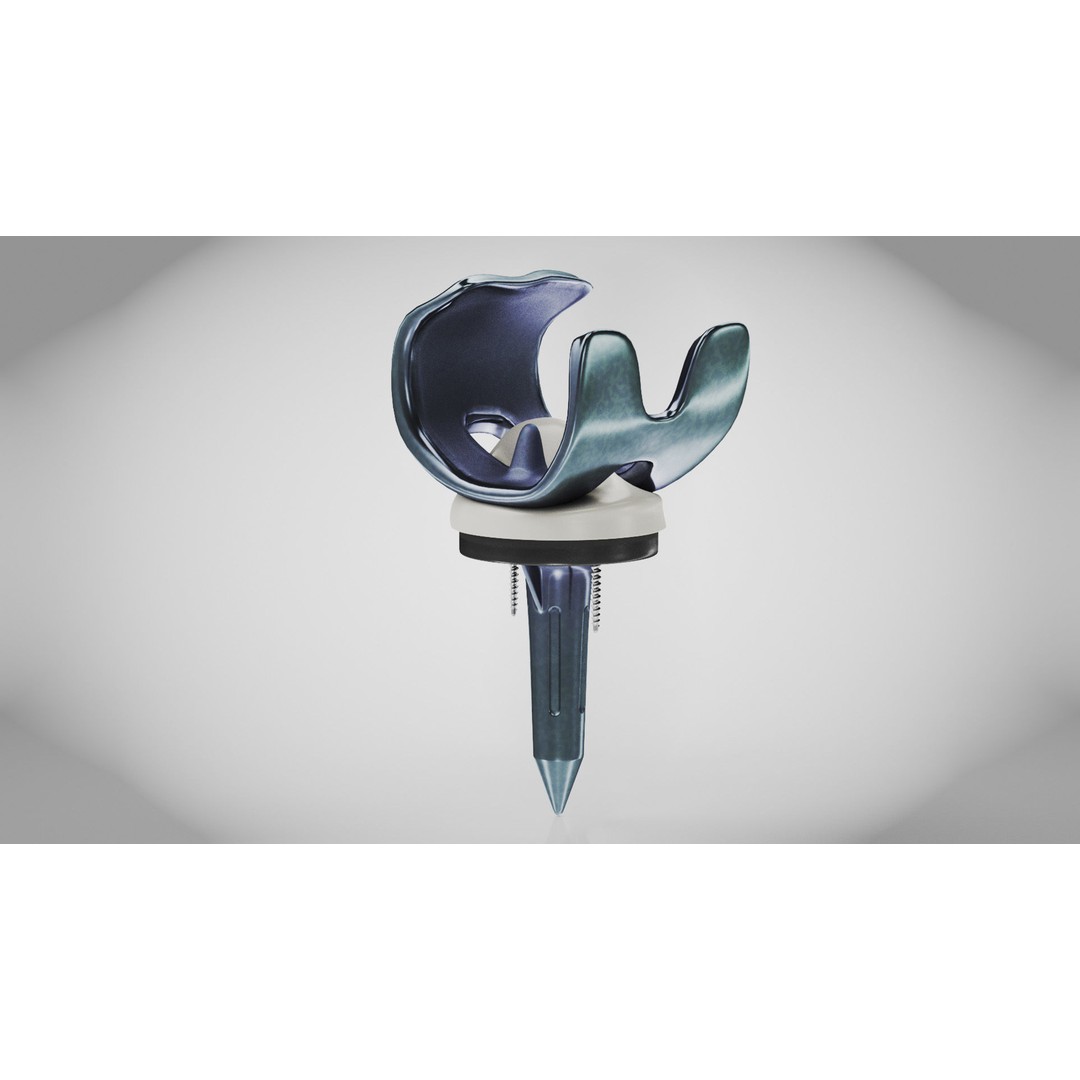 Knee Implant 3D Model – Low Poly Medical Device, PBR Textures, FBX - View 3