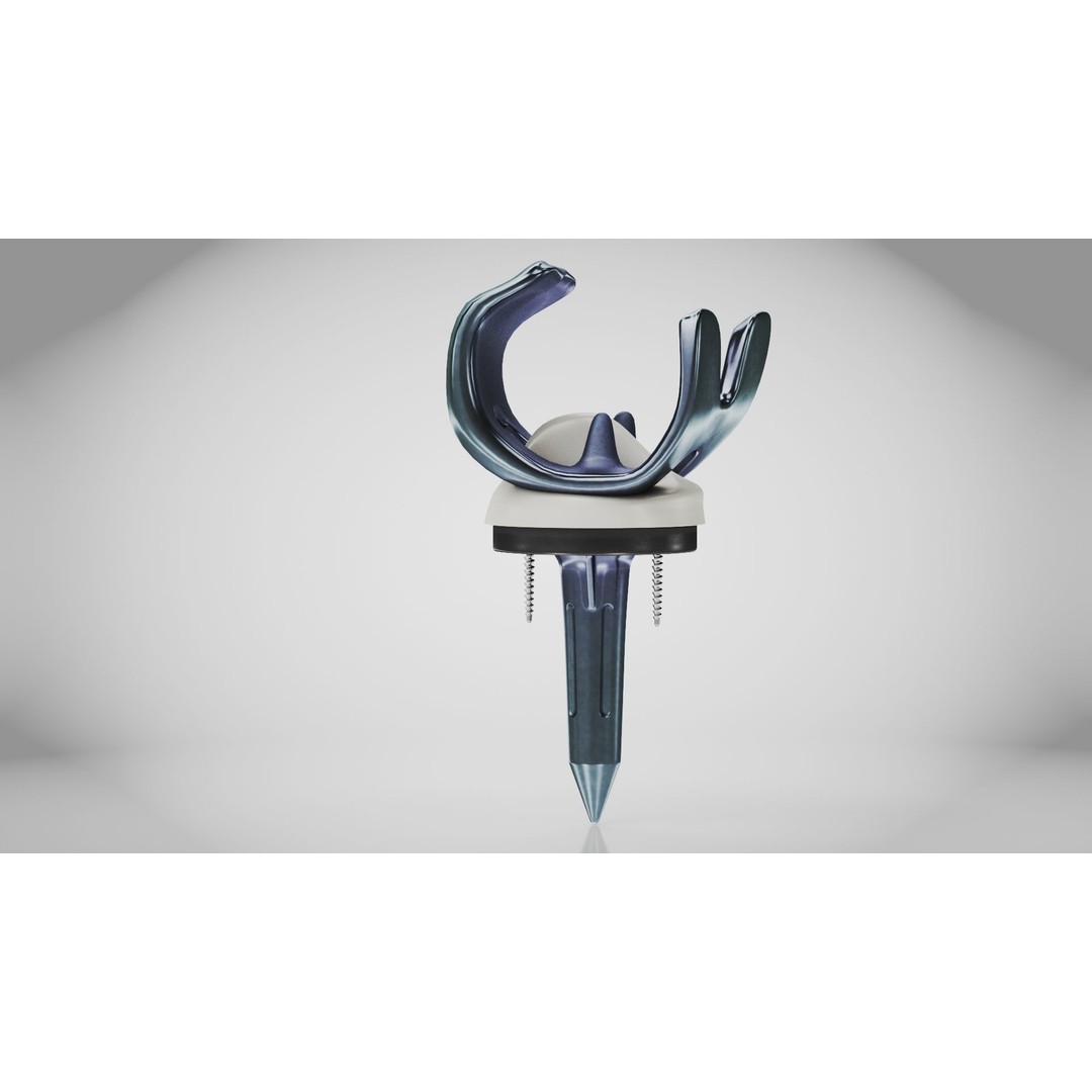 Knee Implant 3D Model – Low Poly Medical Device, PBR Textures, FBX - View 6