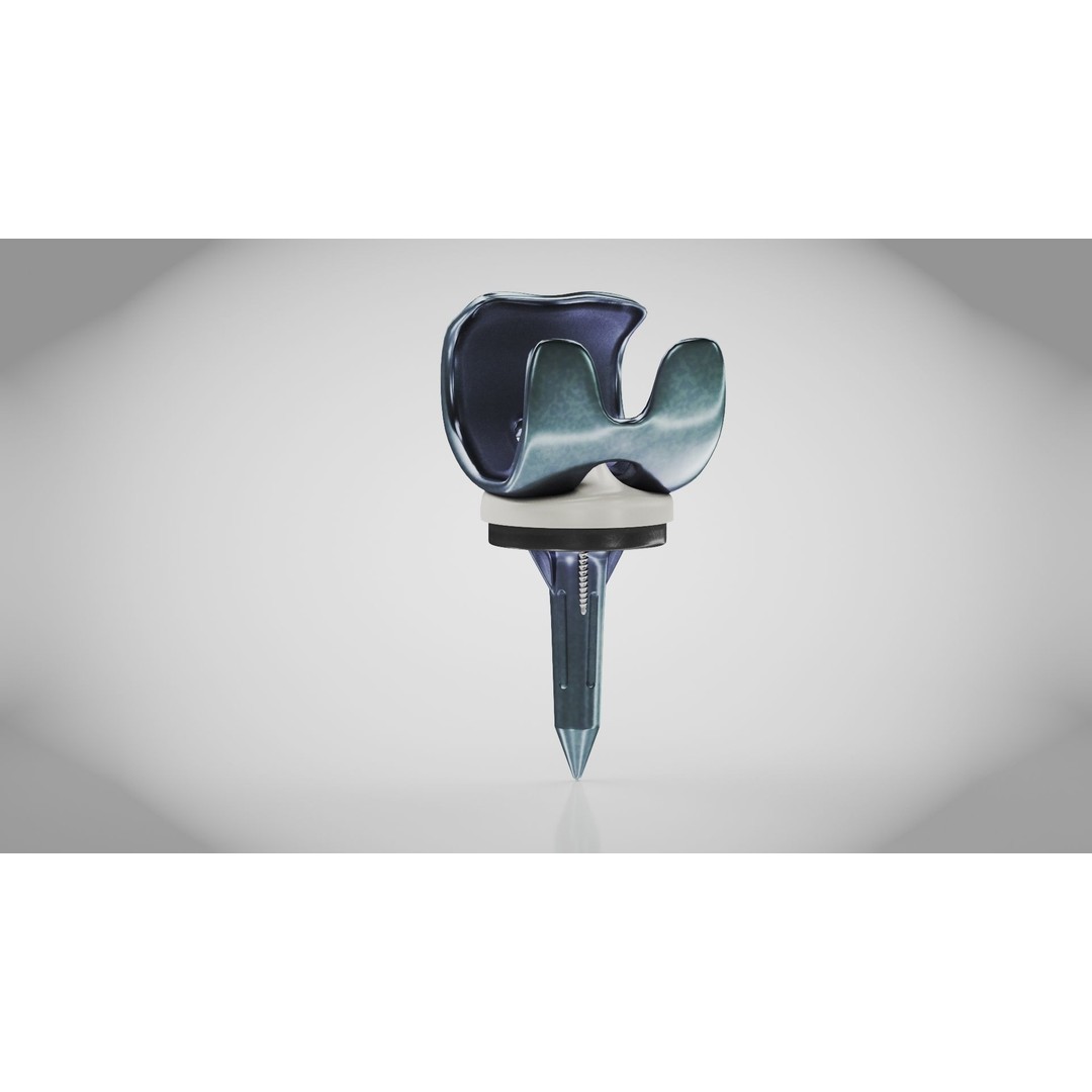 Knee Implant 3D Model – Low Poly Medical Device, PBR Textures, FBX - View 9