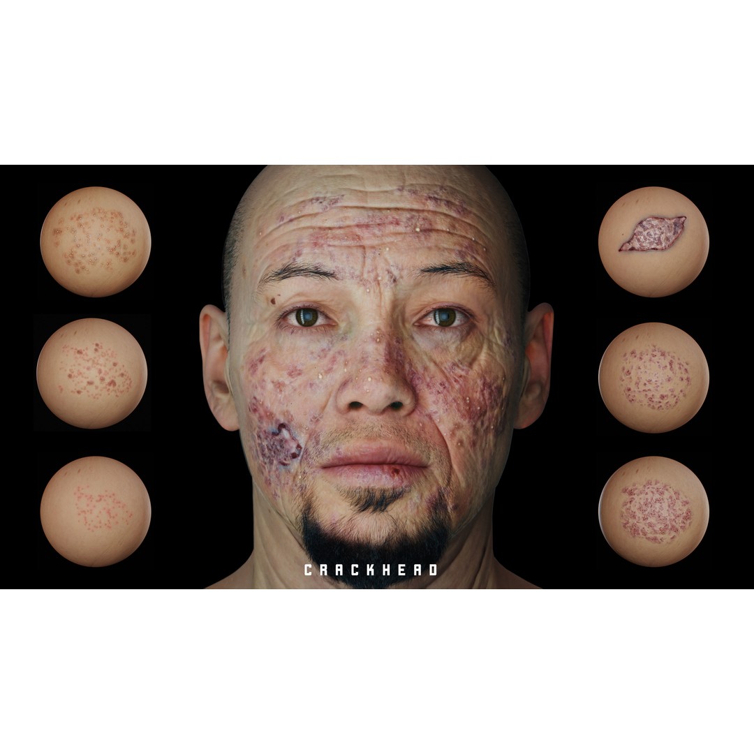 Character Imperfection Brush 3D Model – Customizable Skin Textures, SPSM - View 5