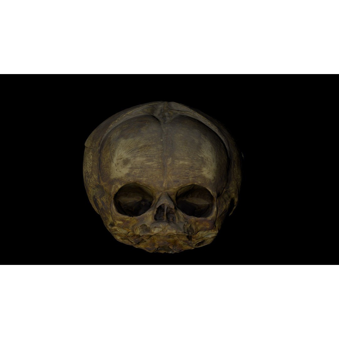 Fetus Skull 3D Model – High Poly Photogrammetry Scan, OBJ, FBX - View 21