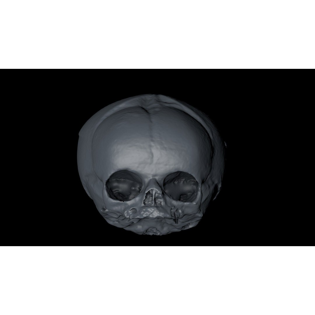 Fetus Skull 3D Model – High Poly Photogrammetry Scan, OBJ, FBX - View 27