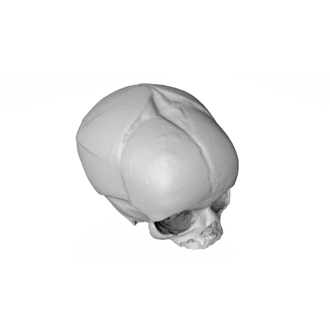 Fetus Skull 3D Model – High Poly Photogrammetry Scan, OBJ, FBX - View 9