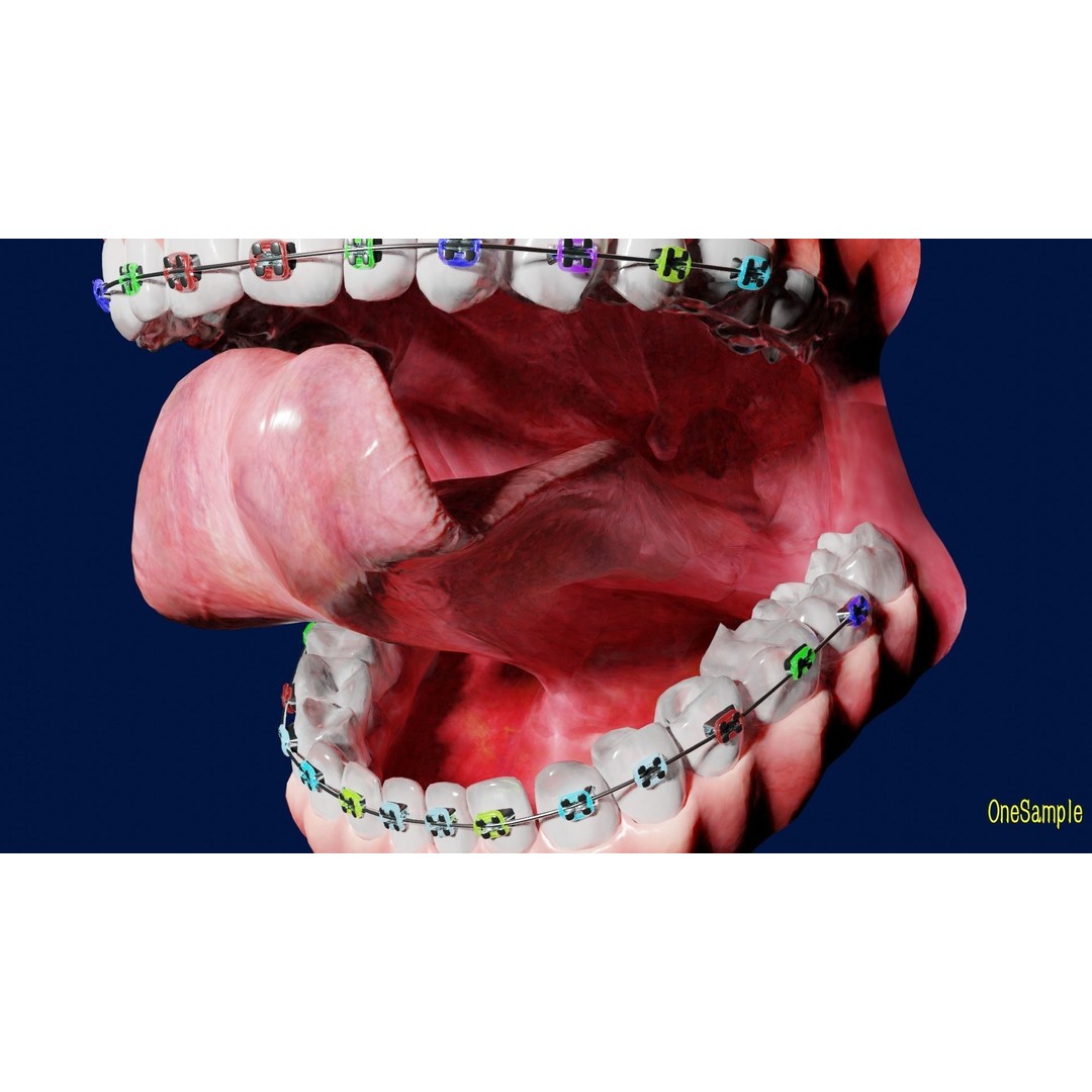 Mouth with Braces 3D Model – Low Poly Rigged Character Asset, Blender - View 10