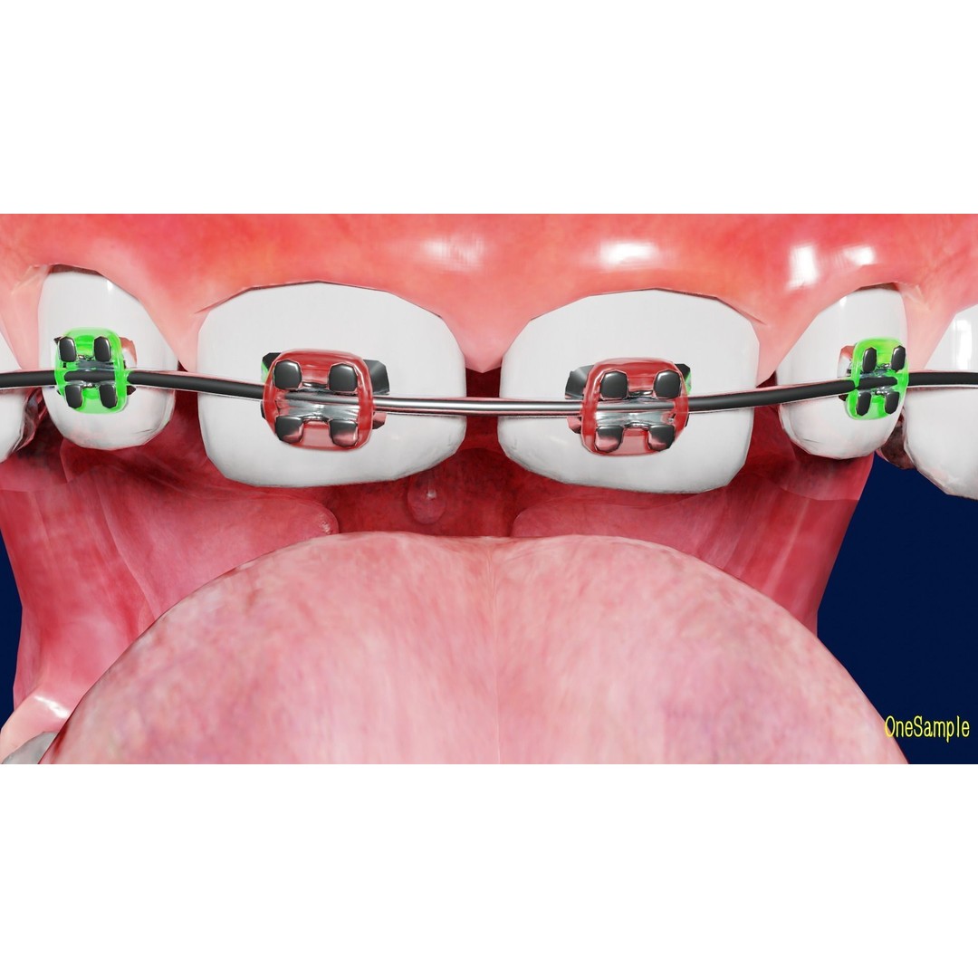 Mouth with Braces 3D Model – Low Poly Rigged Character Asset, Blender - View 12