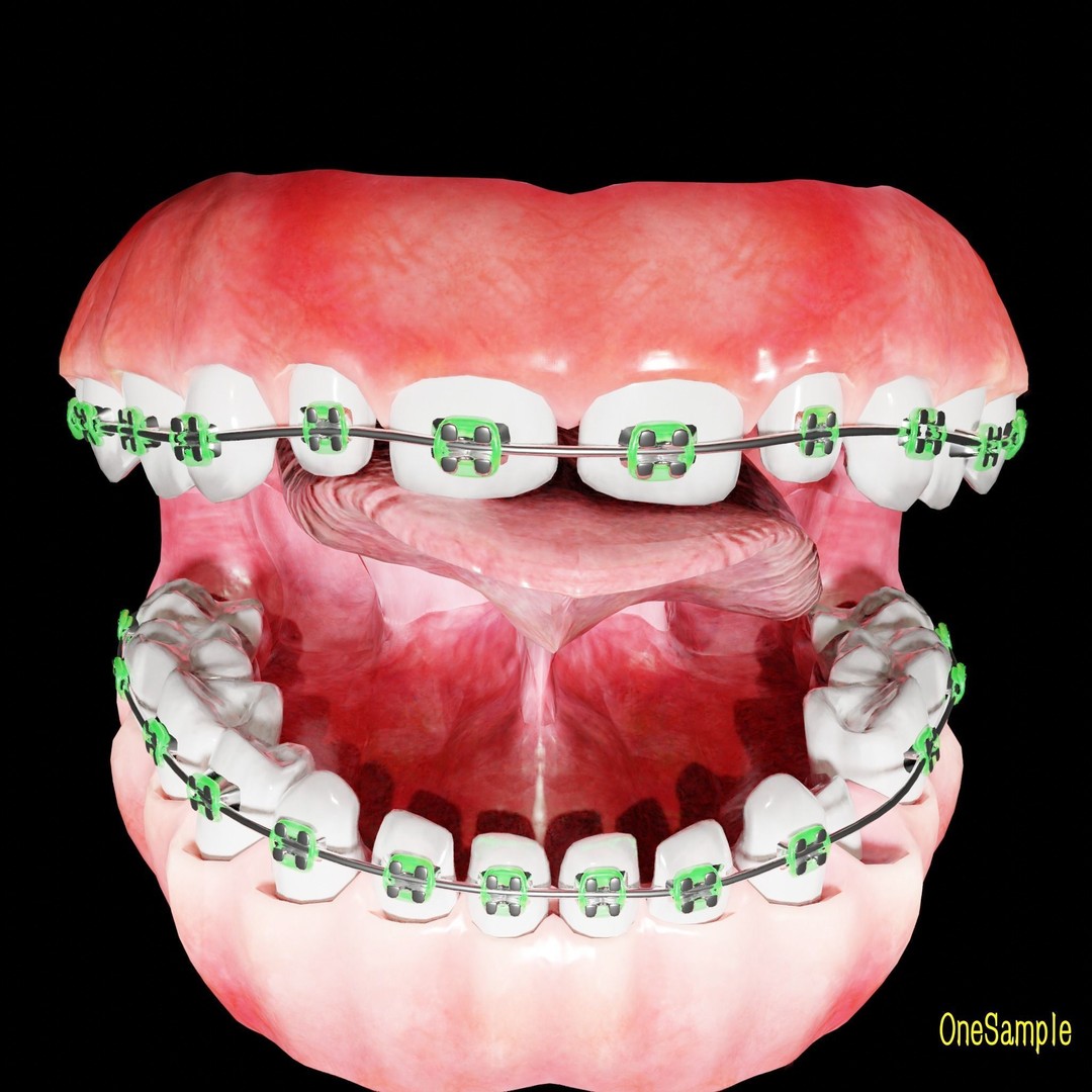 Mouth with Braces 3D Model – Low Poly Rigged Character Asset, Blender - View 17