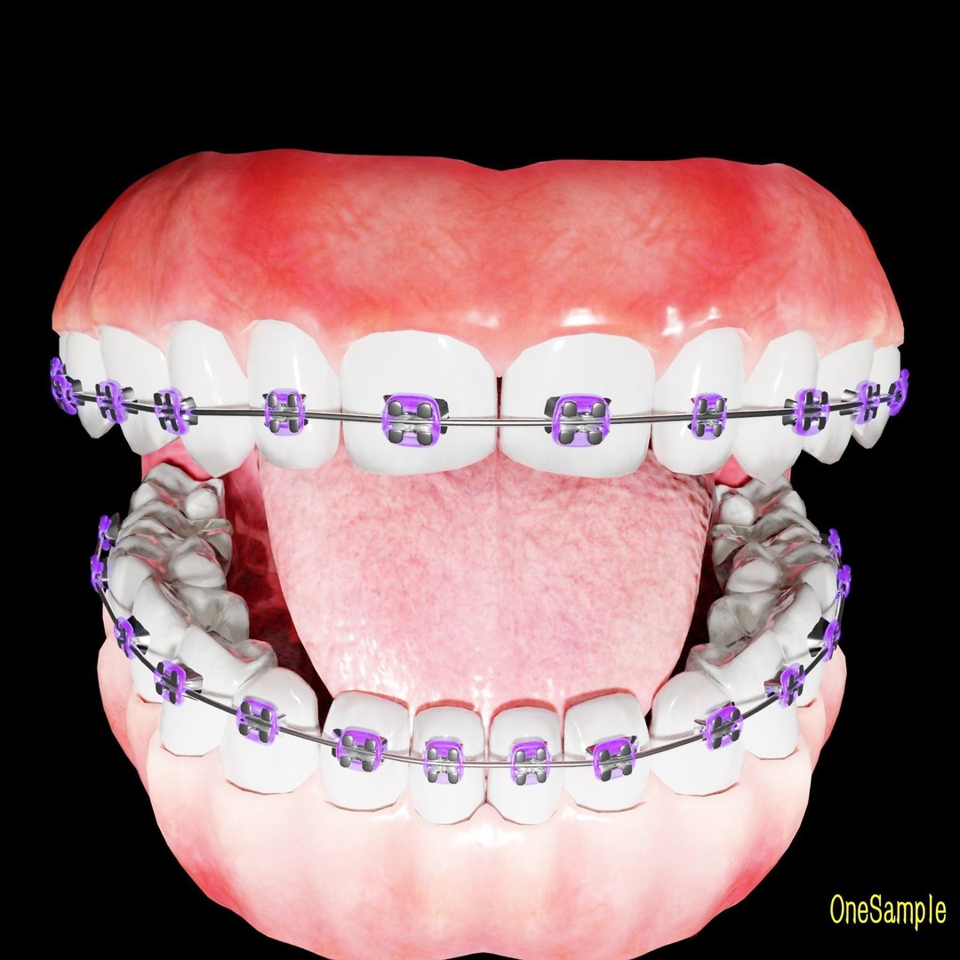 Mouth with Braces 3D Model – Low Poly Rigged Character Asset, Blender - View 18