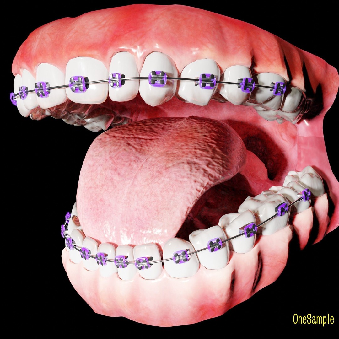 Mouth with Braces 3D Model – Low Poly Rigged Character Asset, Blender - View 19
