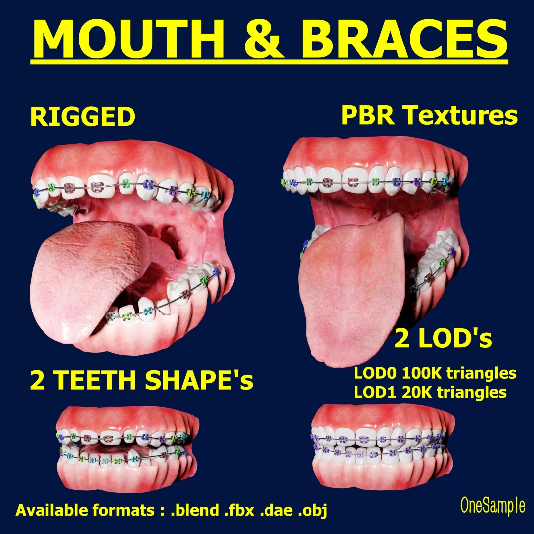 Mouth with Braces 3D Model – Low Poly Rigged Character Asset, Blender - View 2