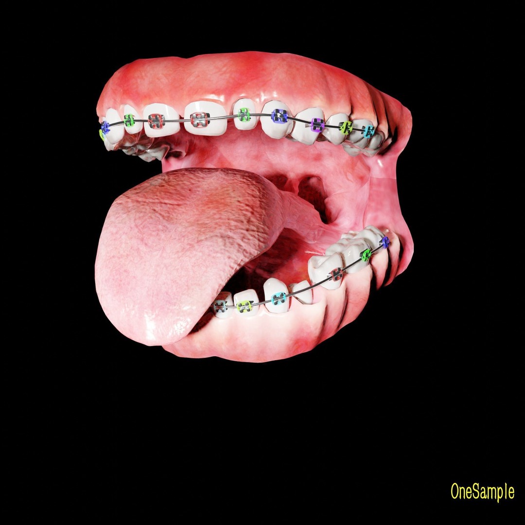Mouth with Braces 3D Model – Low Poly Rigged Character Asset, Blender - View 24