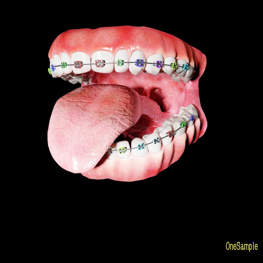 Mouth with Braces 3D Model – Low Poly Rigged Character Asset, Blender - View 25