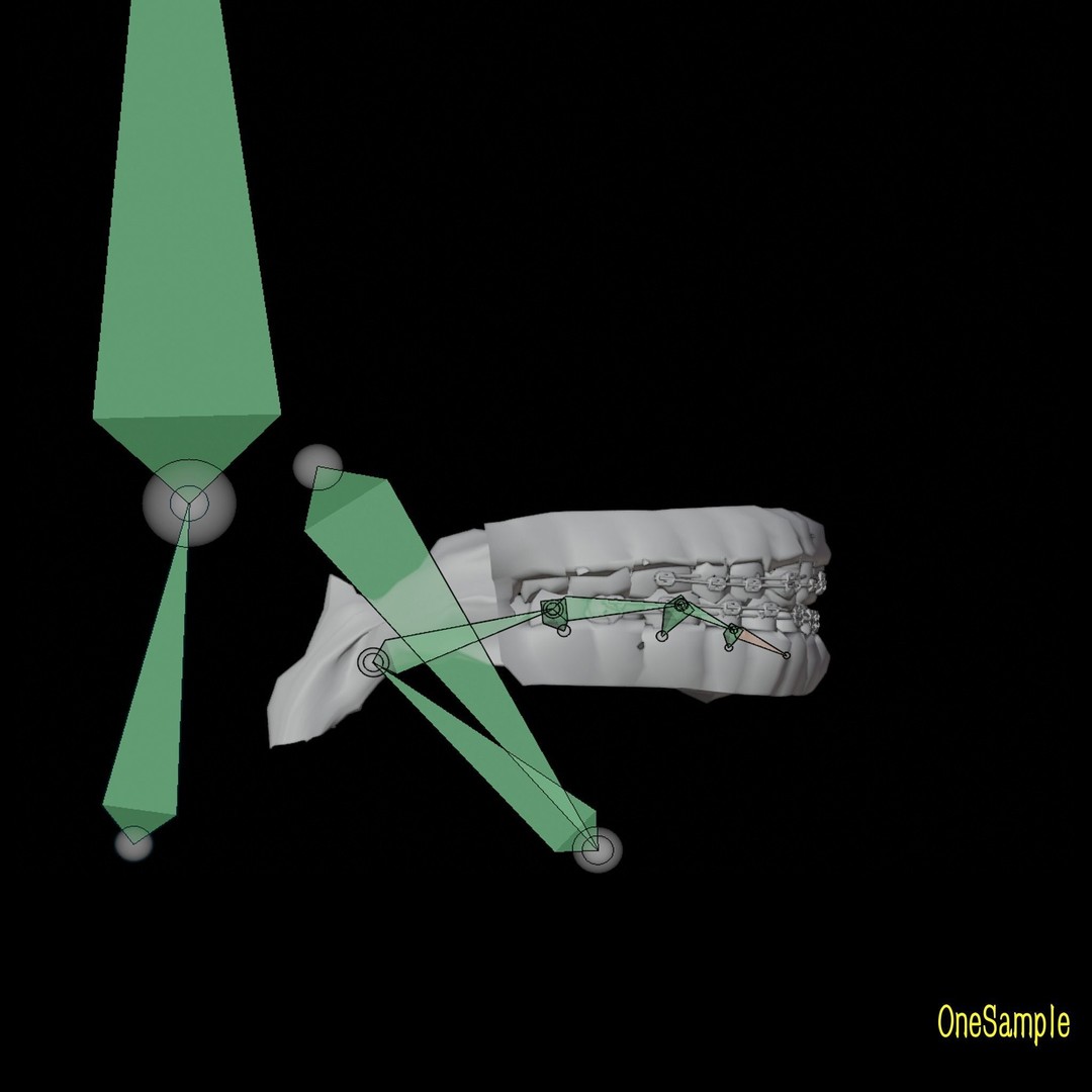Mouth with Braces 3D Model – Low Poly Rigged Character Asset, Blender - View 28