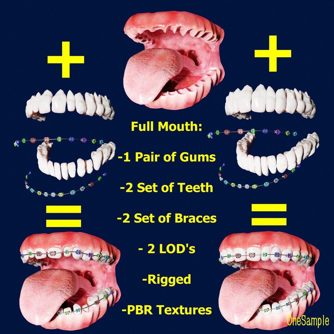 Mouth with Braces 3D Model – Low Poly Rigged Character Asset, Blender - View 3