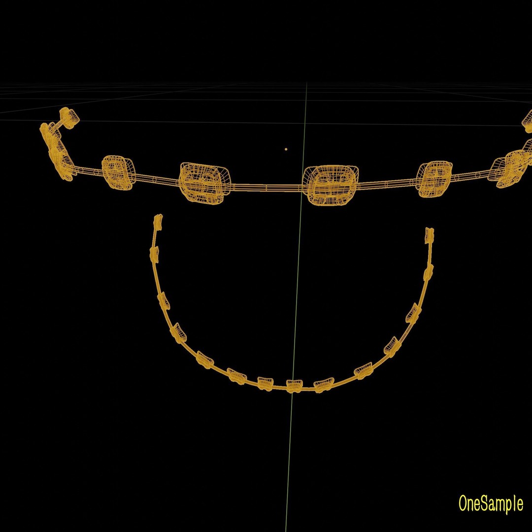 Mouth with Braces 3D Model – Low Poly Rigged Character Asset, Blender - View 32