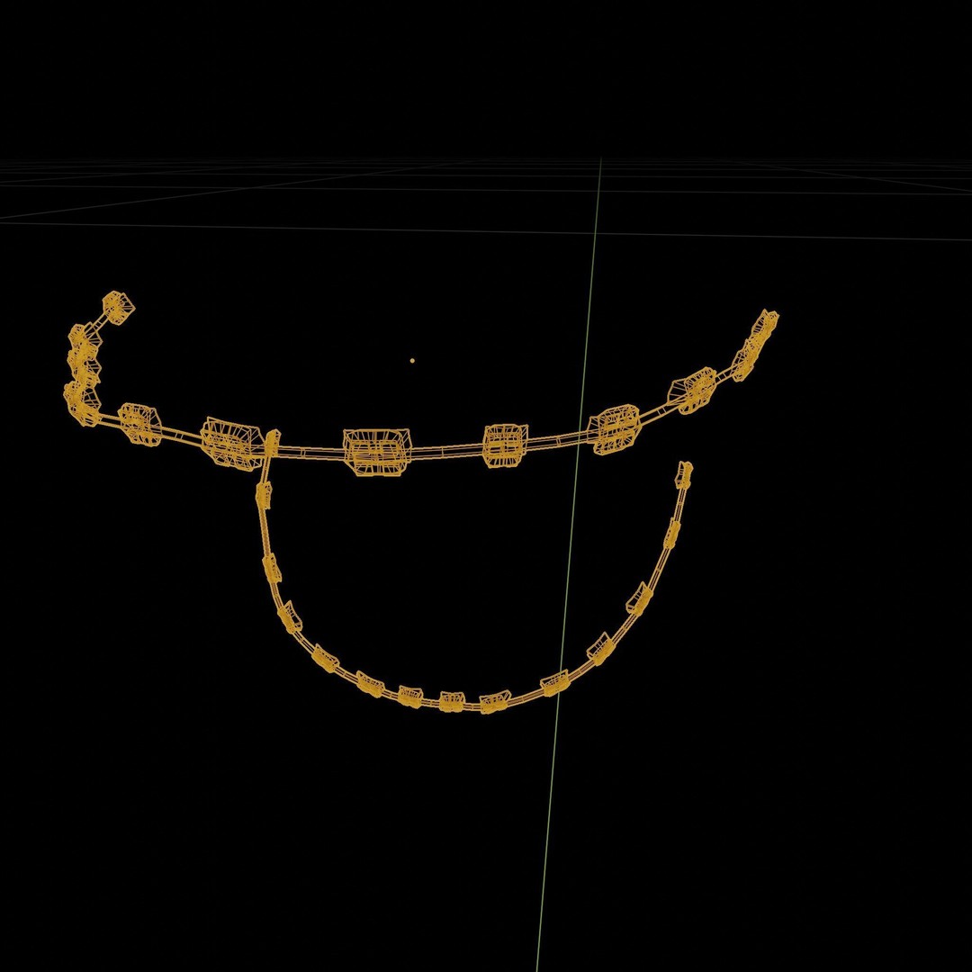 Mouth with Braces 3D Model – Low Poly Rigged Character Asset, Blender - View 35