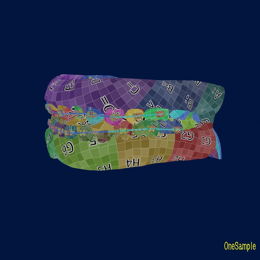 Mouth with Braces 3D Model – Low Poly Rigged Character Asset, Blender - View 39