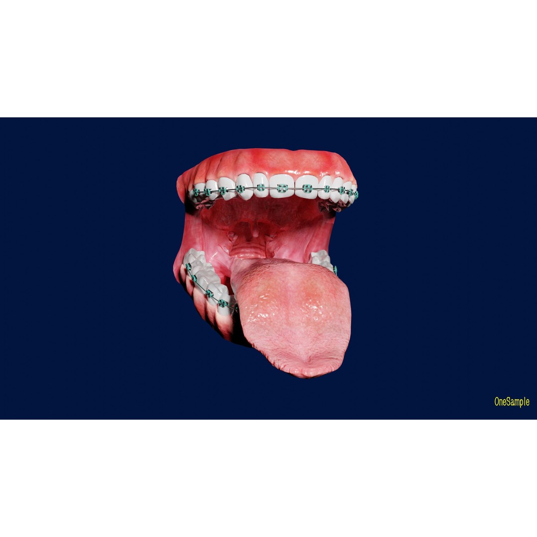 Mouth with Braces 3D Model – Low Poly Rigged Character Asset, Blender - View 4