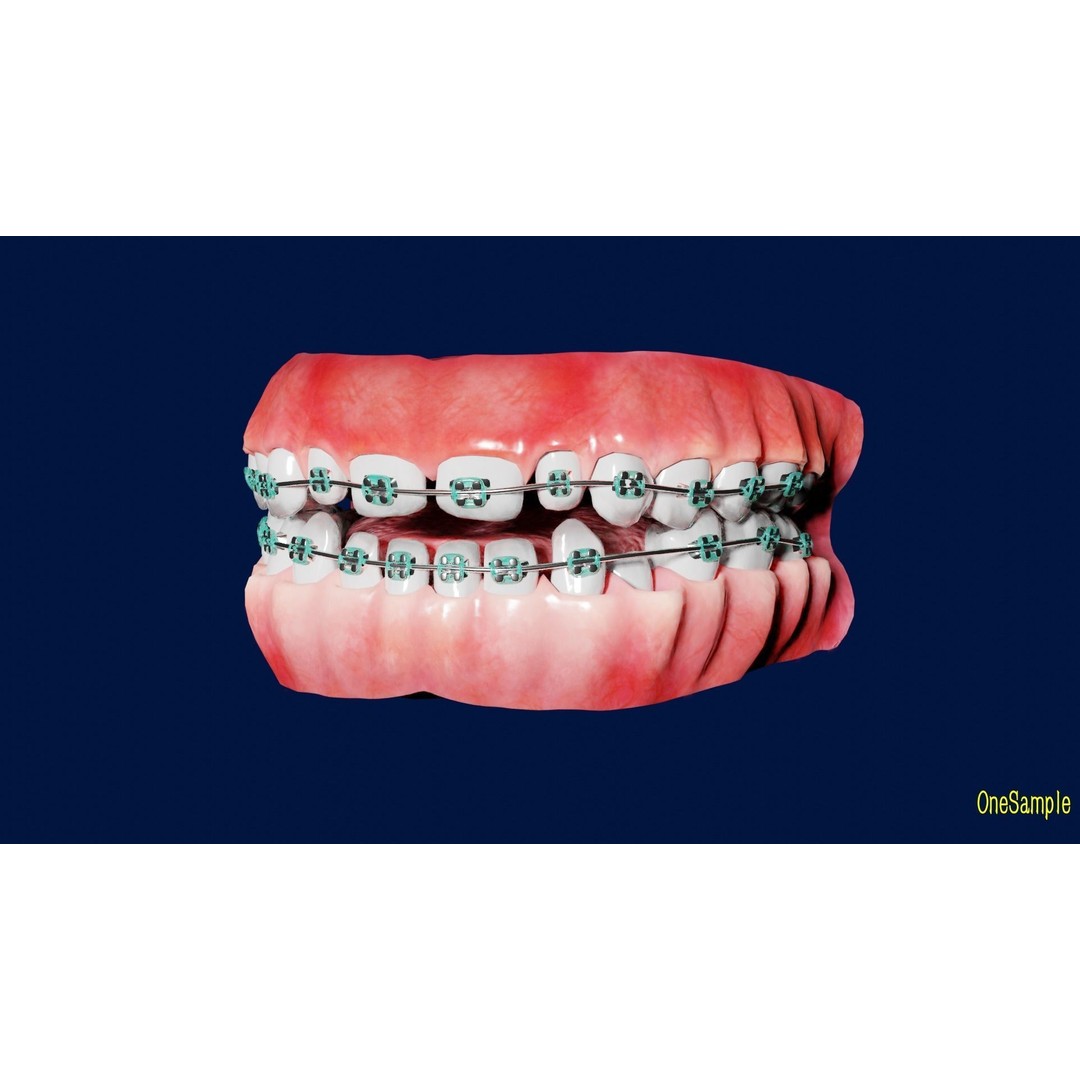 Mouth with Braces 3D Model – Low Poly Rigged Character Asset, Blender - View 5