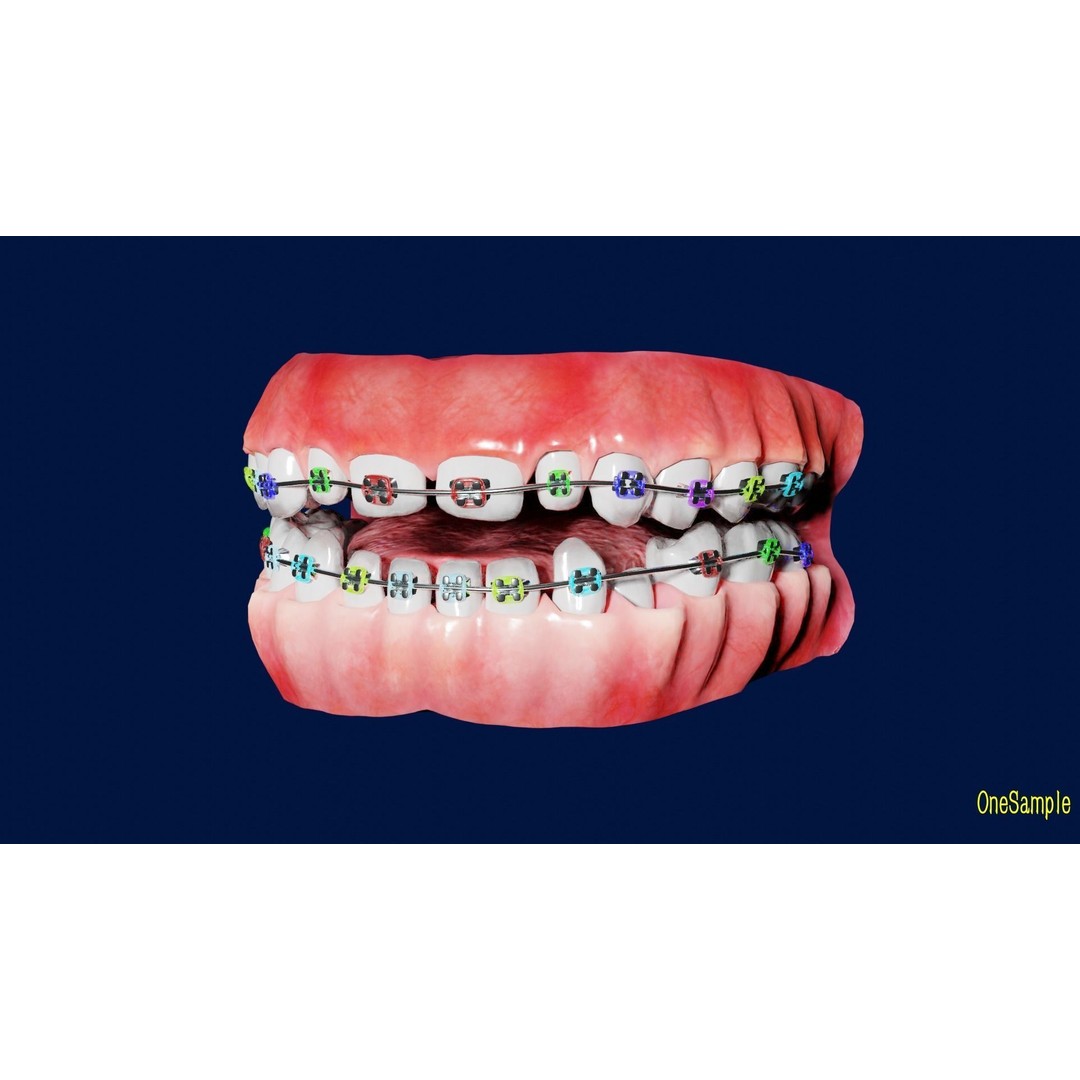 Mouth with Braces 3D Model – Low Poly Rigged Character Asset, Blender - View 7