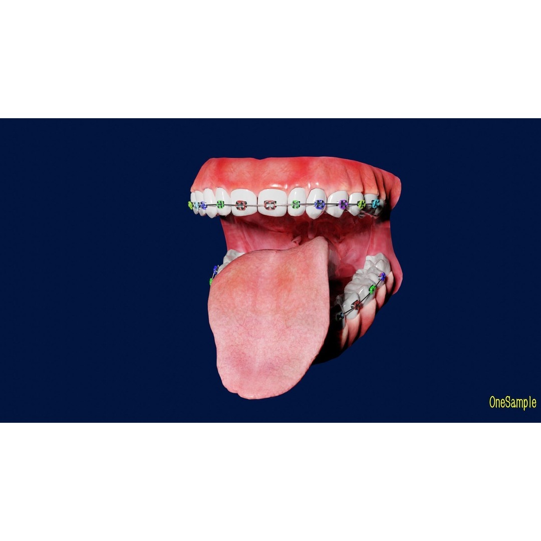 Mouth with Braces 3D Model – Low Poly Rigged Character Asset, Blender - View 8