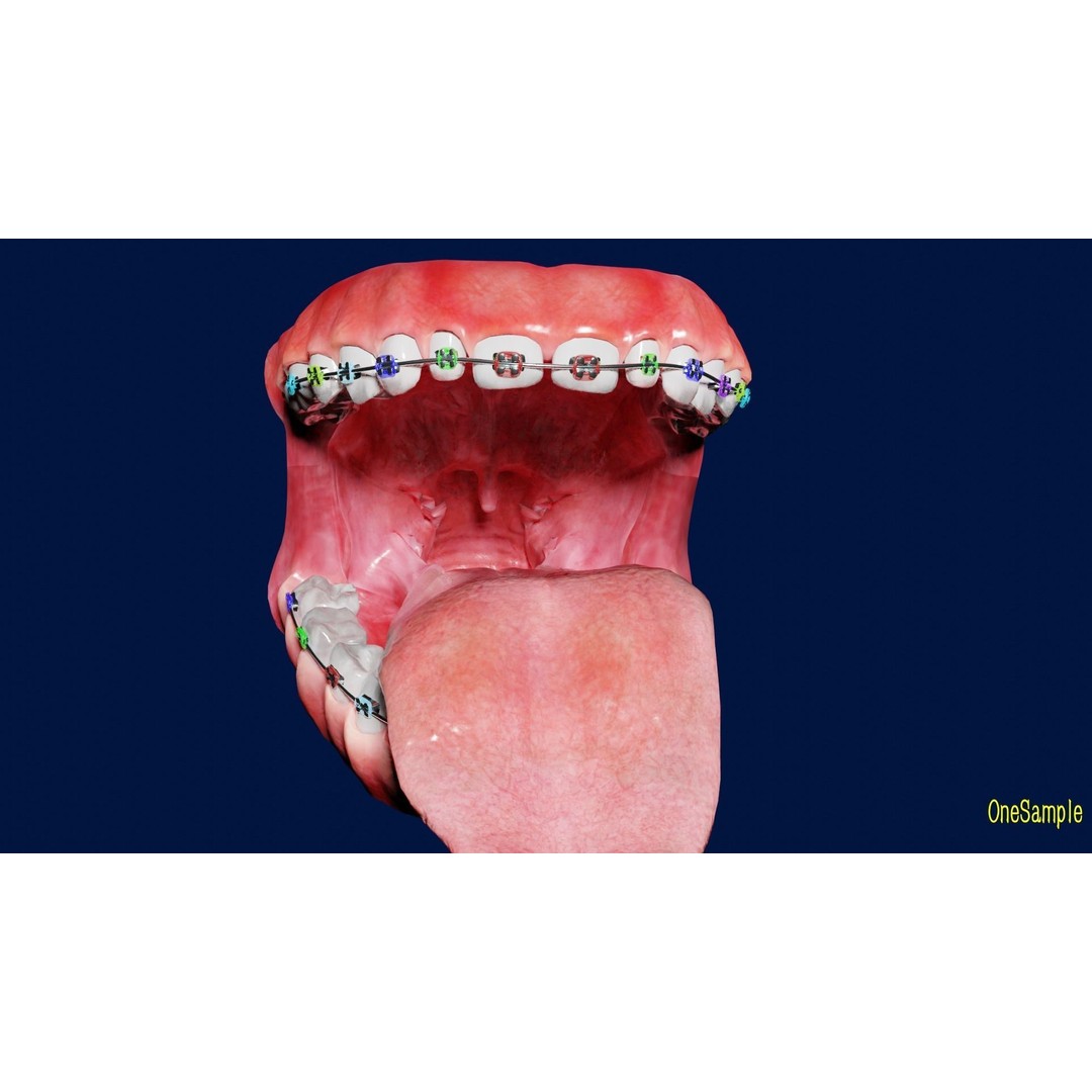 Mouth with Braces 3D Model – Low Poly Rigged Character Asset, Blender - View 9
