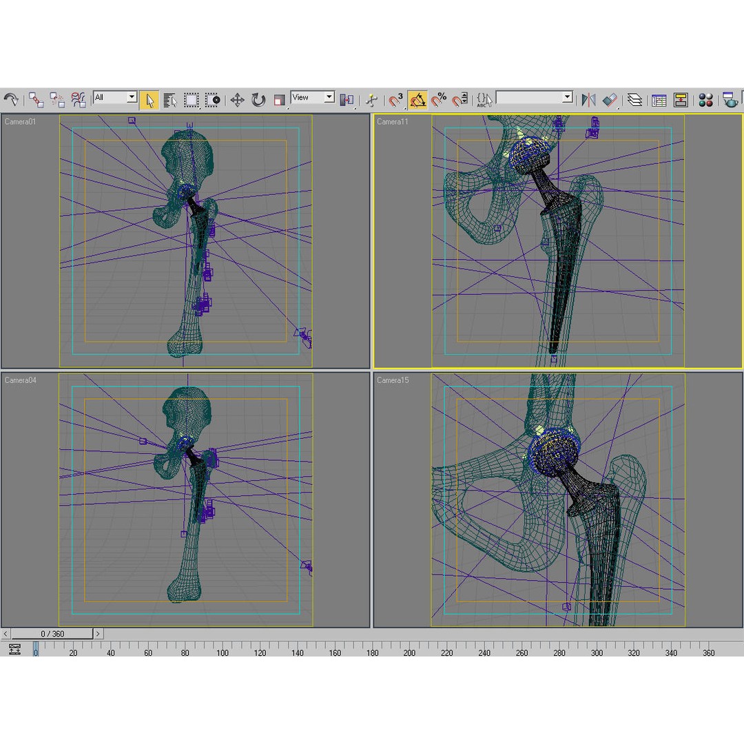 Femoral Prosthesis 3D Model – Realistic Medical Implant, FBX, OBJ