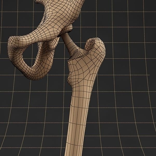 Femoral Prosthesis 3D Model – Realistic Medical Implant, FBX, OBJ - View 10