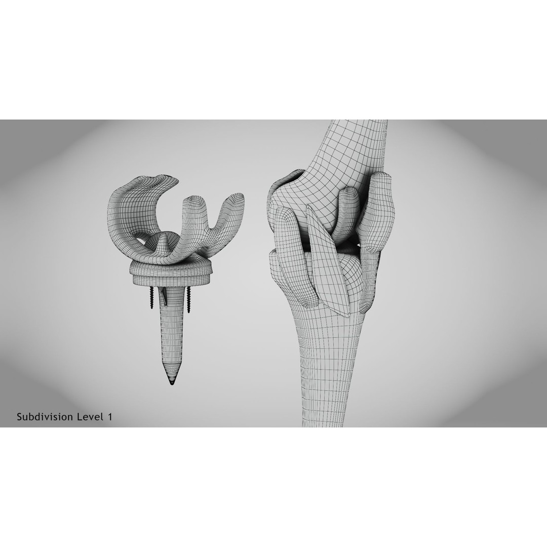 Knee Implant 3D Model – Low Poly Medical Asset, PBR Textures