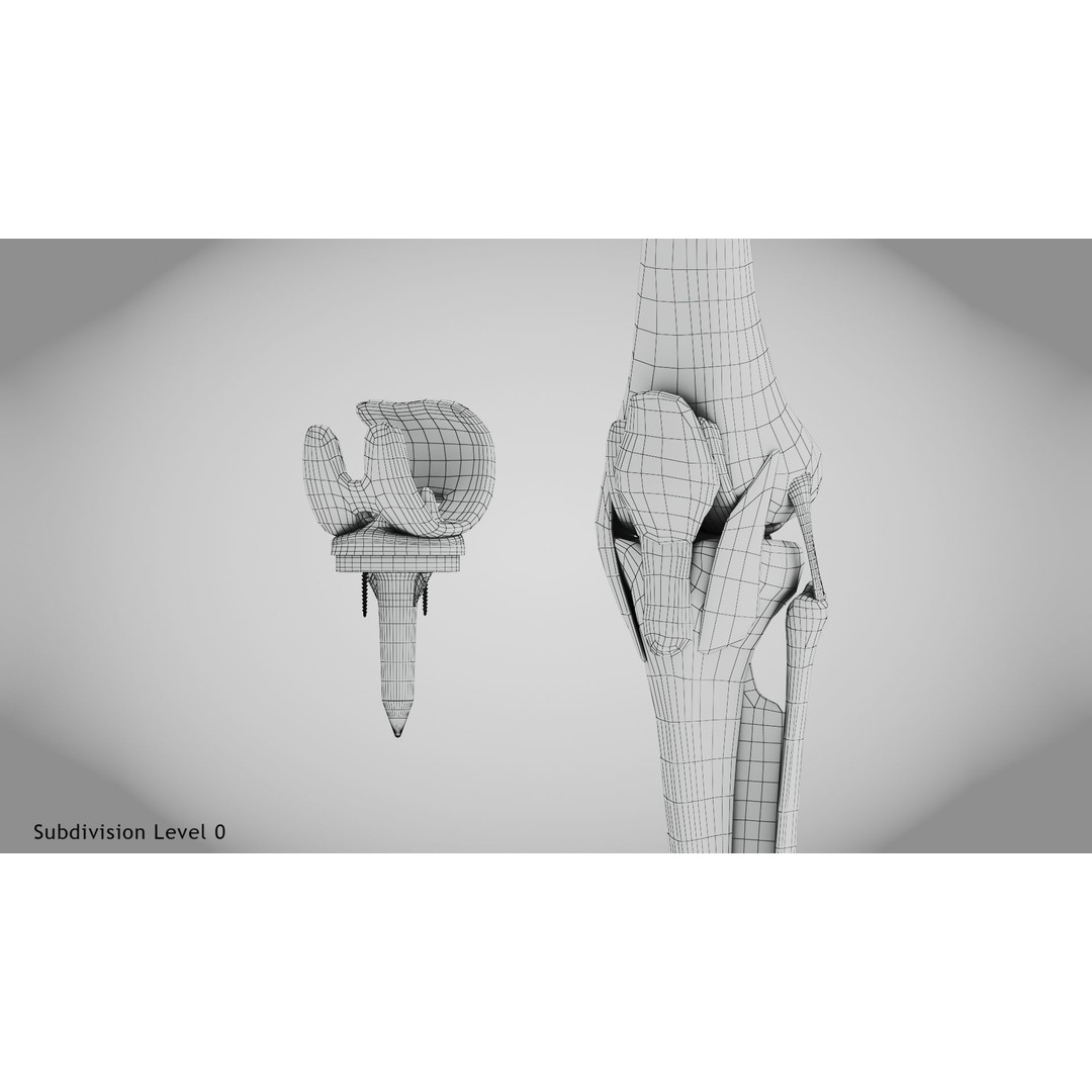 Knee Implant 3D Model – Low Poly Medical Asset, PBR Textures - View 15