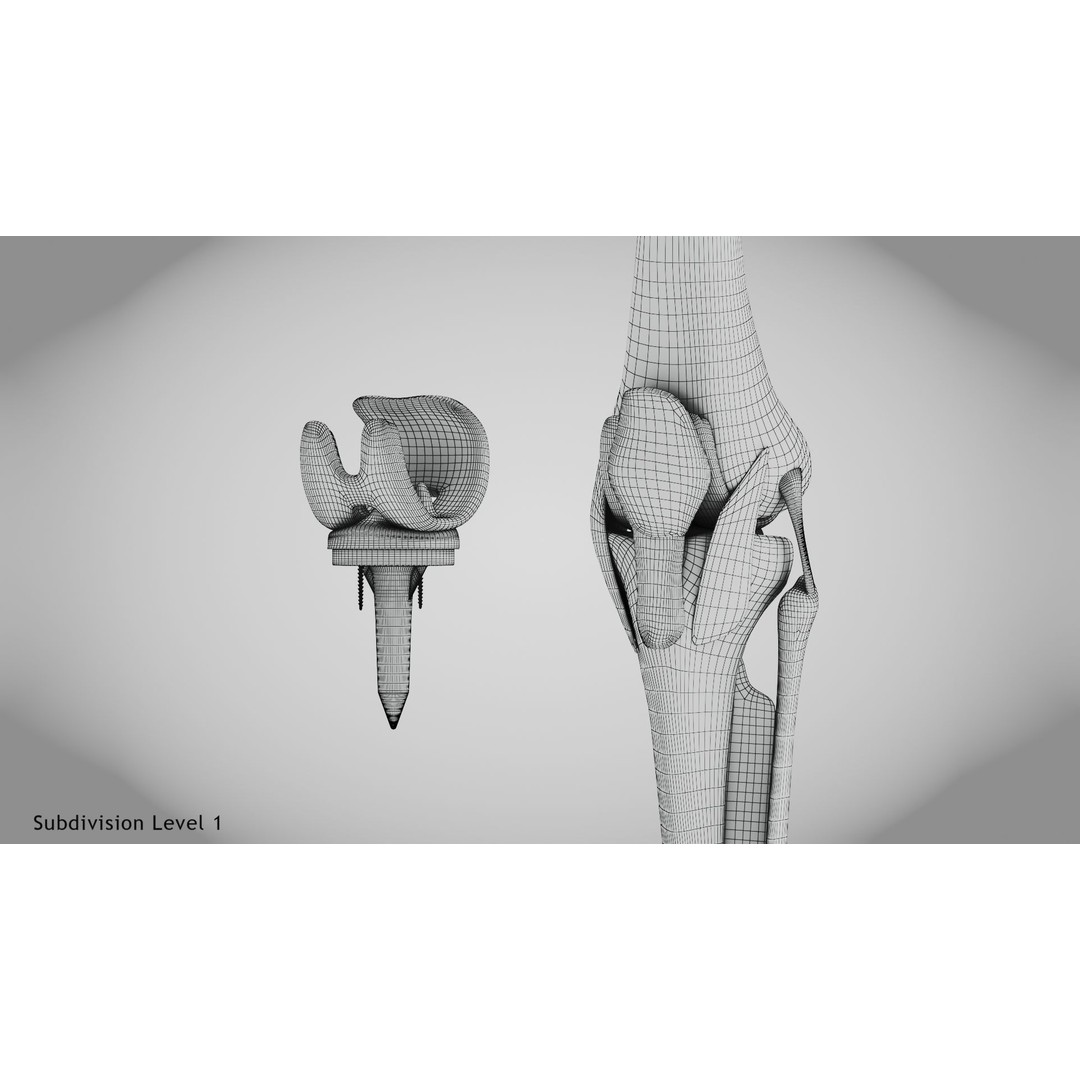 Knee Implant 3D Model – Low Poly Medical Asset, PBR Textures - View 16