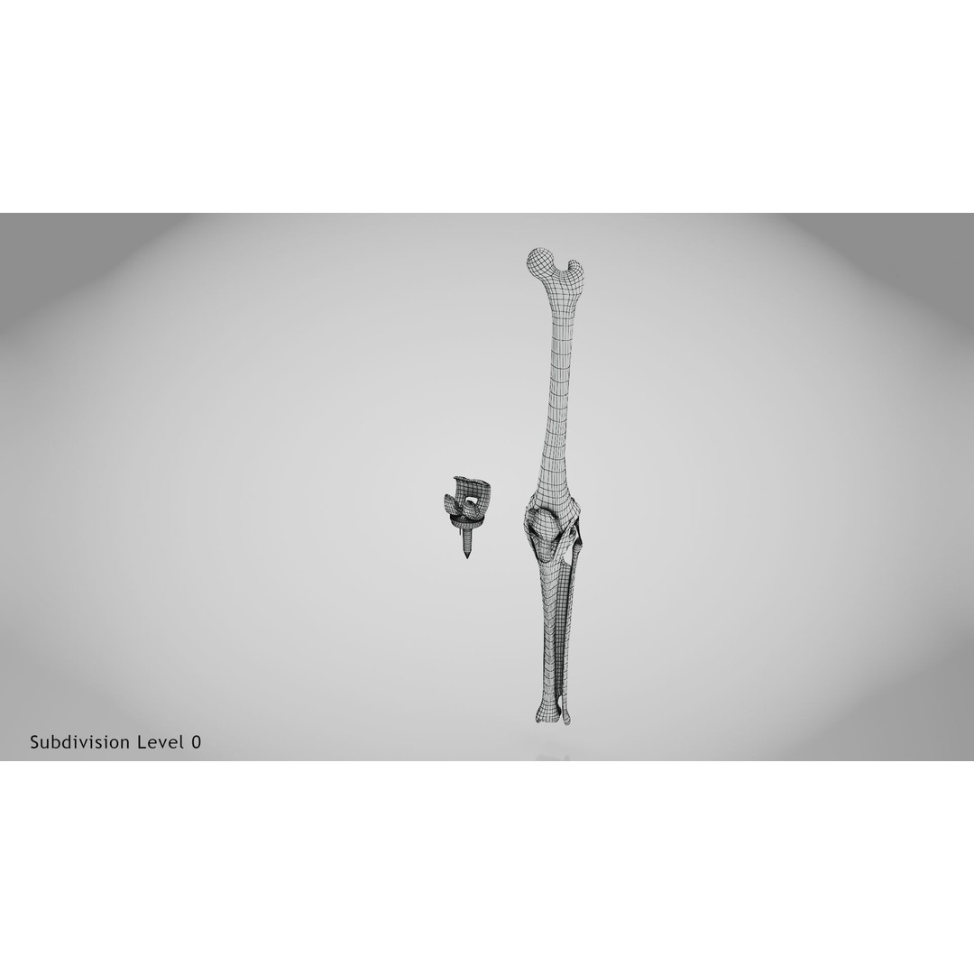Knee Implant 3D Model – Low Poly Medical Asset, PBR Textures - View 17