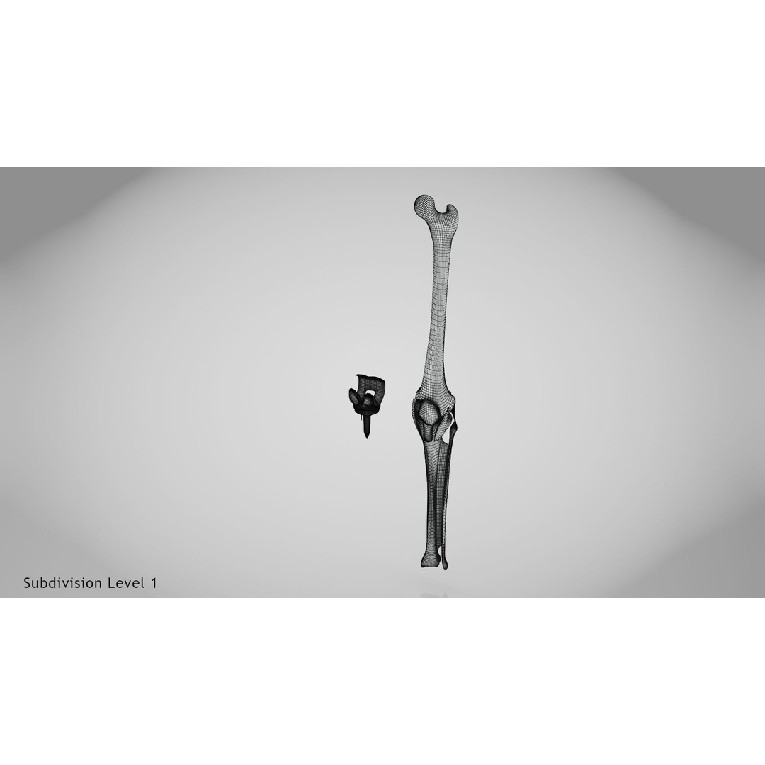 Knee Implant 3D Model – Low Poly Medical Asset, PBR Textures - View 18