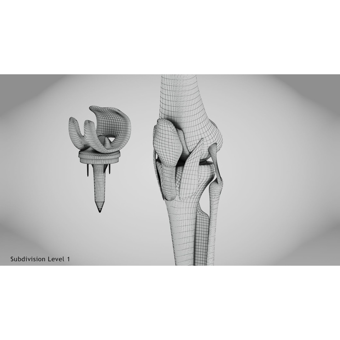 Knee Implant 3D Model – Low Poly Medical Asset, PBR Textures - View 22