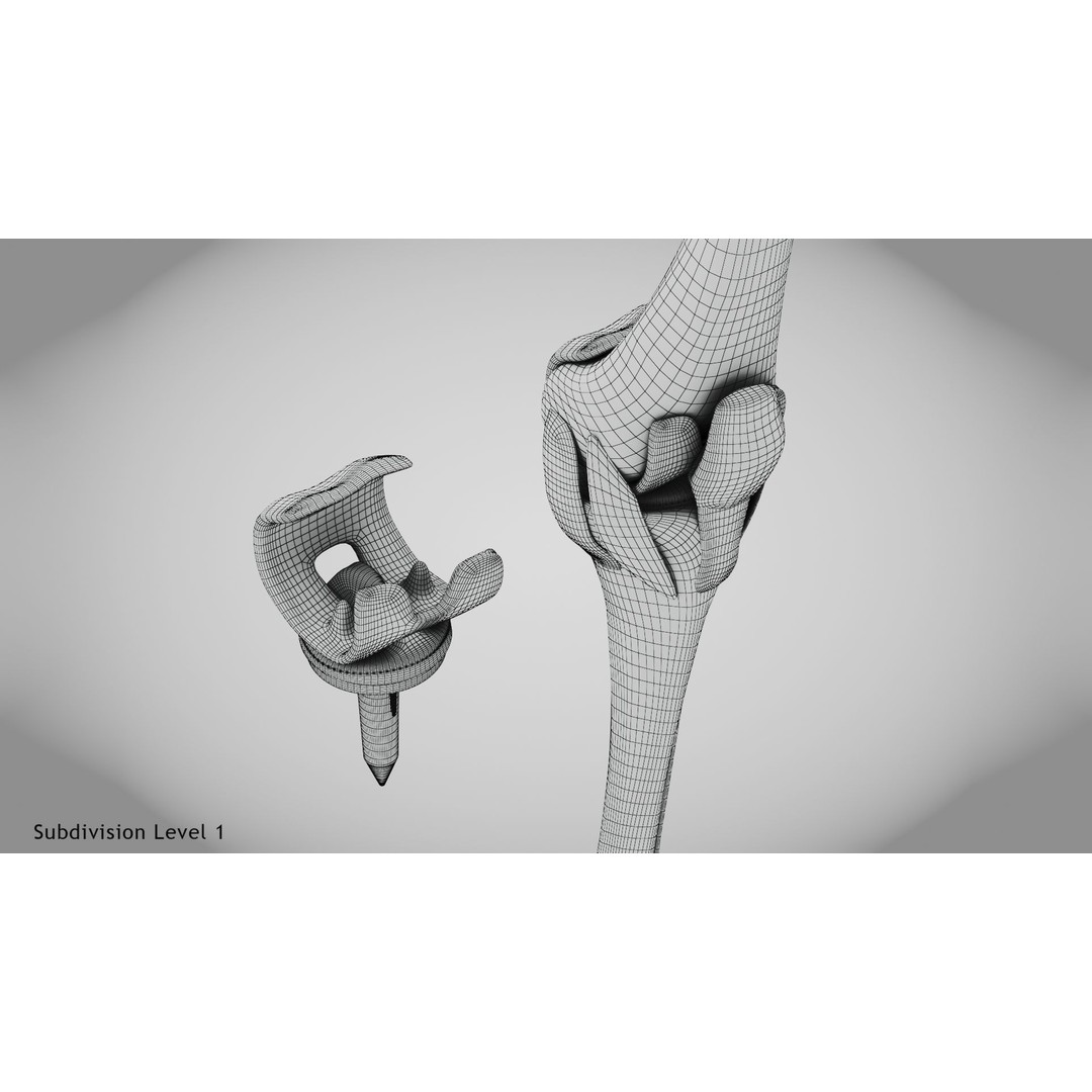Knee Implant 3D Model – Low Poly Medical Asset, PBR Textures - View 23