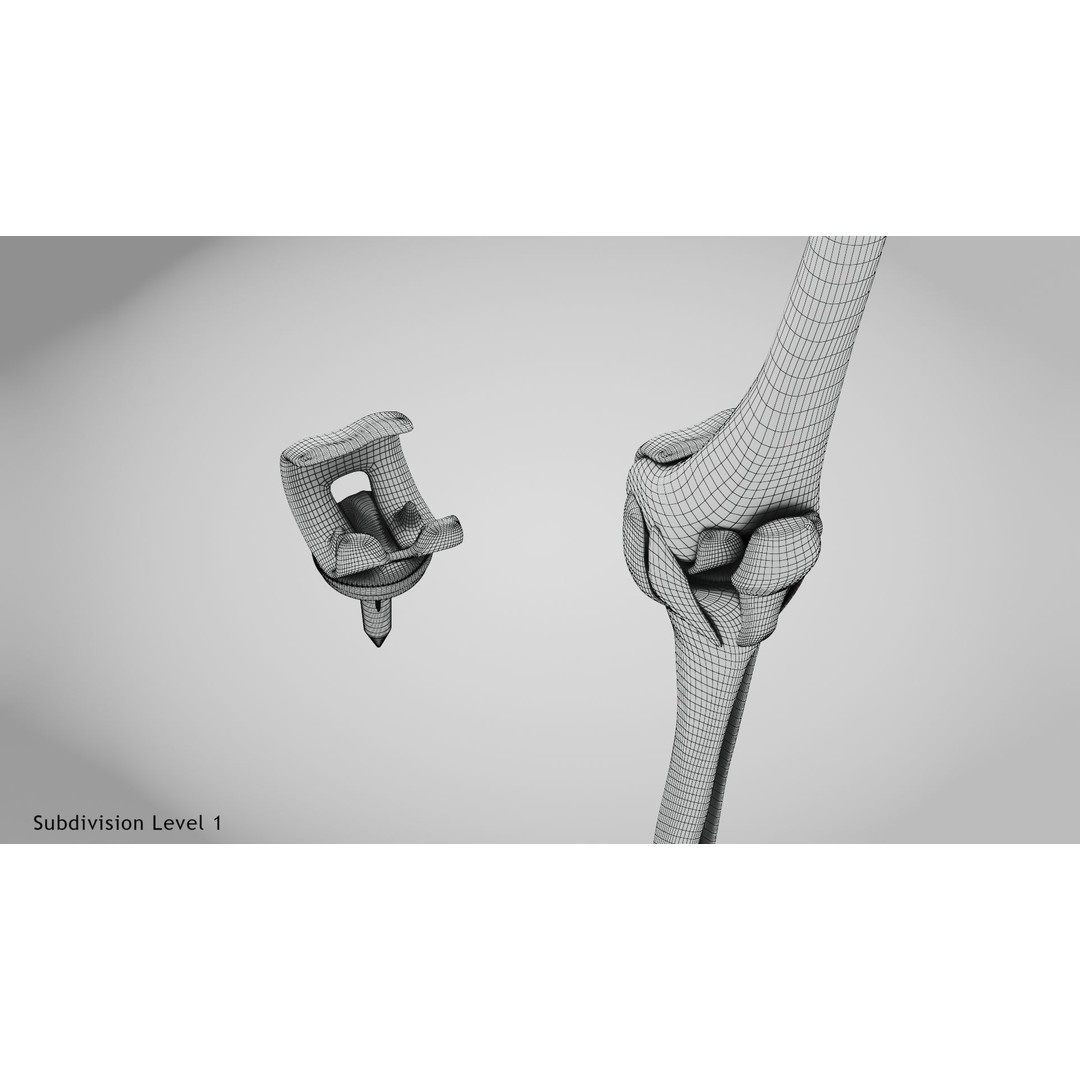 Knee Implant 3D Model – Low Poly Medical Asset, PBR Textures - View 27