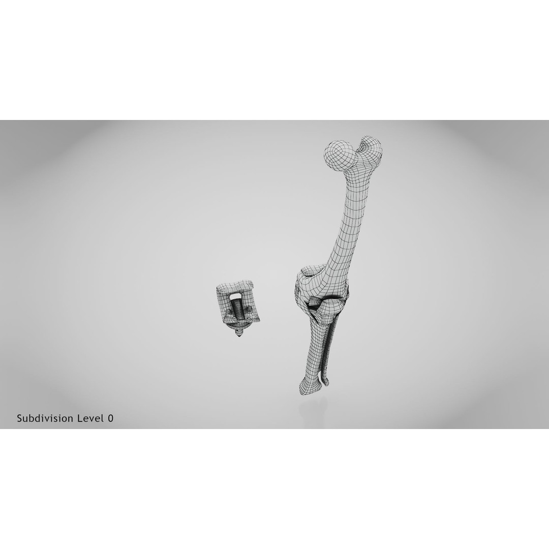 Knee Implant 3D Model – Low Poly Medical Asset, PBR Textures - View 28